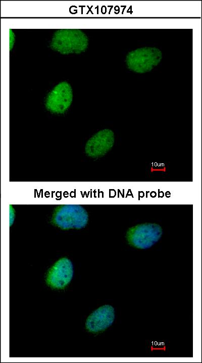 Immunofluorescence of paraformaldehyde-fixed HeLa using ITPK1 antibody at 1:200 dilution.