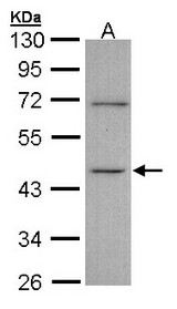 Sample (30 ug of whole cell lysate). A: A431 . 10% SDS PAGE. ITPK1 antibody diluted at 1:1000