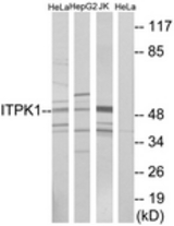 Western blot of extracts from HeLa/HepG2/Jurkat cells, using ITPK1 Antibody. The lane on the right is treated with the synthesized peptide.
