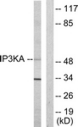 Western blot of extracts from HUVEC cells, using IP3KA Antibody. The lane on the right is treated with the synthesized peptide.