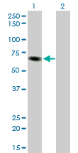 Western Blot analysis of ITPKB expression in transfected 293T cell line by ITPKB monoclonal antibody (M01), clone 2F8.Lane 1: ITPKB transfected lysate(67.4 KDa).Lane 2: Non-transfected lysate.