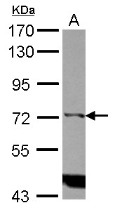 Sample (30 ug of whole cell lysate) A: Raji 7.5% SDS PAGE ITPKC / IP3KC antibody diluted at 1:1000