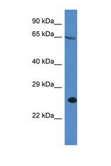ITPRIP antibody LS-C145299 Western blot of A549 Cell lysate. Antibody concentration 1 ug/ml.