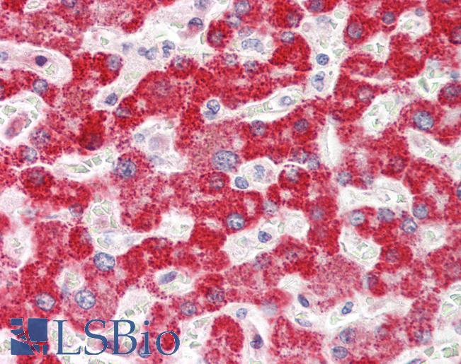 Human Liver: Formalin-Fixed, Paraffin-Embedded (FFPE)