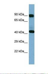 Western blot of Human Fetal Spleen. IVD antibody dilution 1.0 ug/ml.