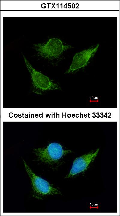 Immunofluorescence of methanol-fixed HeLa using IVD antibody at 1:200 dilution.