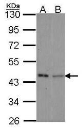 Sample (30 ug of whole cell lysate). A: Hela, B: JurKat. 10% SDS PAGE. IVD antibody diluted at 1:1000.