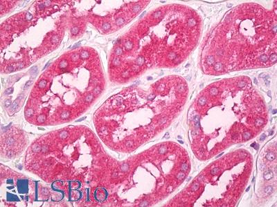 Anti-GNPDA1 antibody IHC of human kidney. Immunohistochemistry of formalin-fixed, paraffin-embedded tissue after heat-induced antigen retrieval. Antibody LS-B8009 dilution 10 ug/ml.