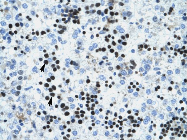 IVNS1ABP antibody LS-C29945 was used in IHC to stain formalin-fixed, paraffin-embedded human liver.