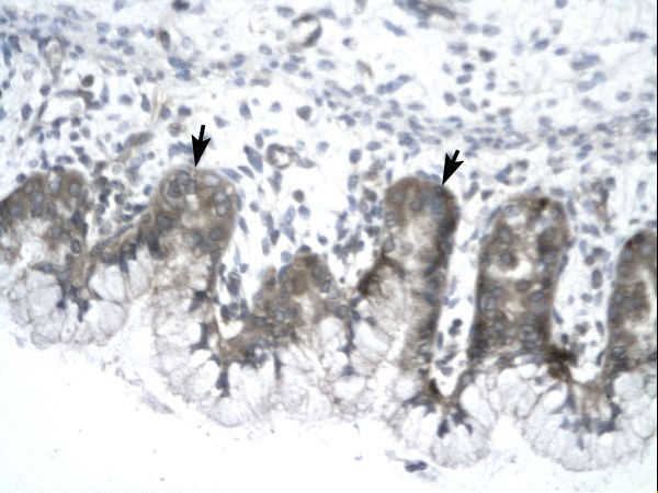 IVNS1ABP antibody LS-C31721 was used in IHC to stain formalin-fixed, paraffin-embedded human stomach.
