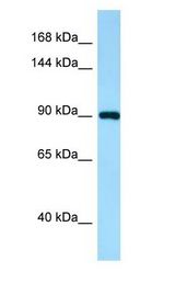 IWS1 antibody Western Blot of Human Kidney.