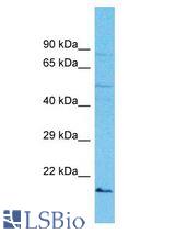 IZUMO2 antibody Western Blot of OVCAR-3. Antibody dilution: 1 ug/ml.