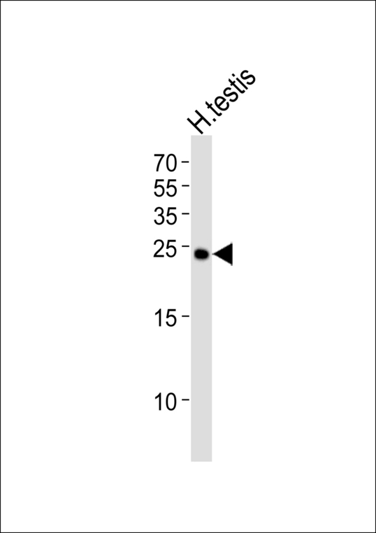 Western blot of lysate from human testis tissue lysate with IZUMO2 Antibody. Antibody was diluted at 1:1000. A goat anti-rabbit IgG H&L (HRP) at 1:5000 dilution was used as the secondary antibody. Lysate at 35 ug.