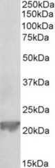 GPX1 antibody (0.3 ug/ml) staining of Rat Liver lysate (35 ug protein in RIPA buffer). Primary incubation was 1 hour. Detected by chemiluminescence.