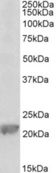 GPX1 antibody (0.1 ug/ml) staining of Rat Liver lysate (35 ug protein in RIPA buffer). Primary incubation was 1 hour. Detected by chemiluminescence.