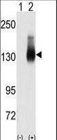 Western blot of Jag2 (arrow) using JAG2 Antibody. 293 cell lysates (2 ug/lane) either nontransfected (Lane 1) or transiently transfected with the JAG2 gene (Lane 2) (Origene Technologies).