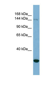 JARID2 antibody LS-C107878 Western blot of HeLa lysate.