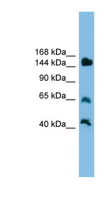 JARID2 antibody LS-C116081 Western blot of Mouse Liver lysate.
