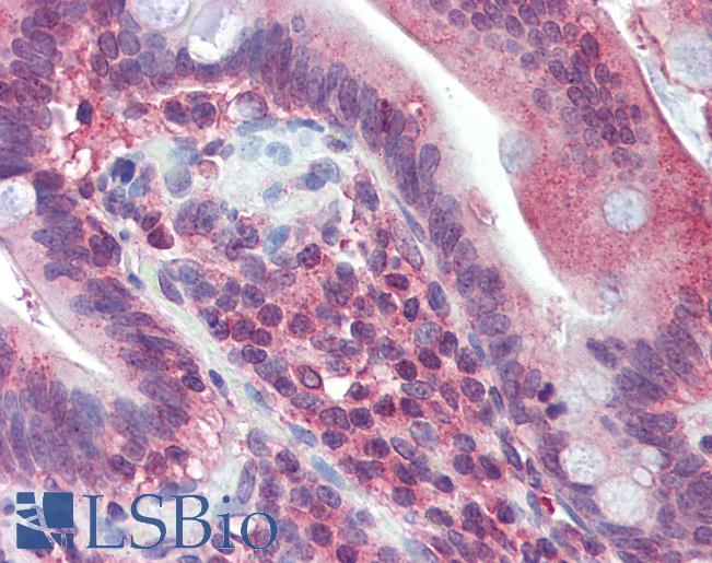 Anti-JAZF1 antibody IHC of human small intestine. Immunohistochemistry of formalin-fixed, paraffin-embedded tissue after heat-induced antigen retrieval. Antibody LS-B3537 concentration 5 ug/ml.