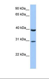 Jurkat cell lysate. Antibody concentration: 1.0 ug/ml. Gel concentration: 12%.