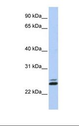 Jurkat cell lysate. Antibody concentration: 1.0 ug/ml. Gel concentration: 12%.