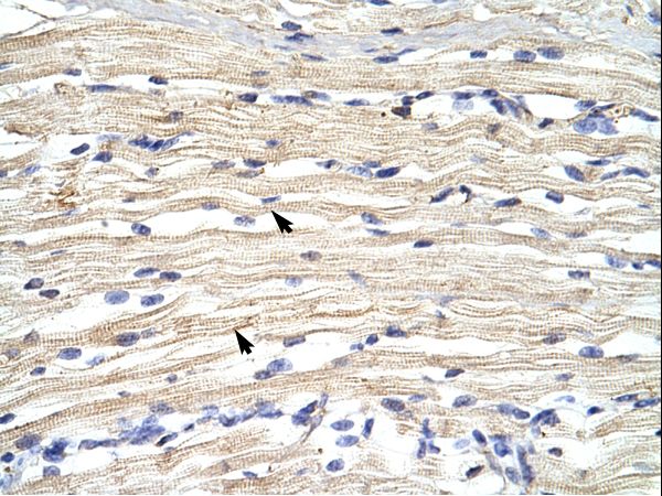 KDM2A / FBXL11 antibody LS-C30281 was used in IHC to stain formalin-fixed, paraffin-embedded human muscle.
