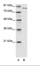 A: Marker, B: HepG2 Cell Lysate