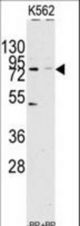 Western blot of anti-JHDM1a/FBXL11 Antibody pre-incubated with(right lane) and without(left lane) blocking peptide in Jurkat cell line lysate. JHDM1a(arrow) was detected using the purified antibody.
