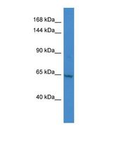 Western blot of Human HepG2. KDM2A antibody dilution 1.0 ug/ml.