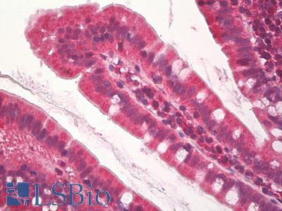 Anti-JHDM1A / KDM2A antibody IHC staining of human small intestine. Immunohistochemistry of formalin-fixed, paraffin-embedded tissue after heat-induced antigen retrieval.