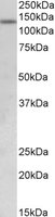KDM2A antibody (0.5 ug/ml) staining of Human Uterus lysate (35 ug protein/ml in RIPA buffer). Primary incubation was 1 hour. Detected by chemiluminescence.