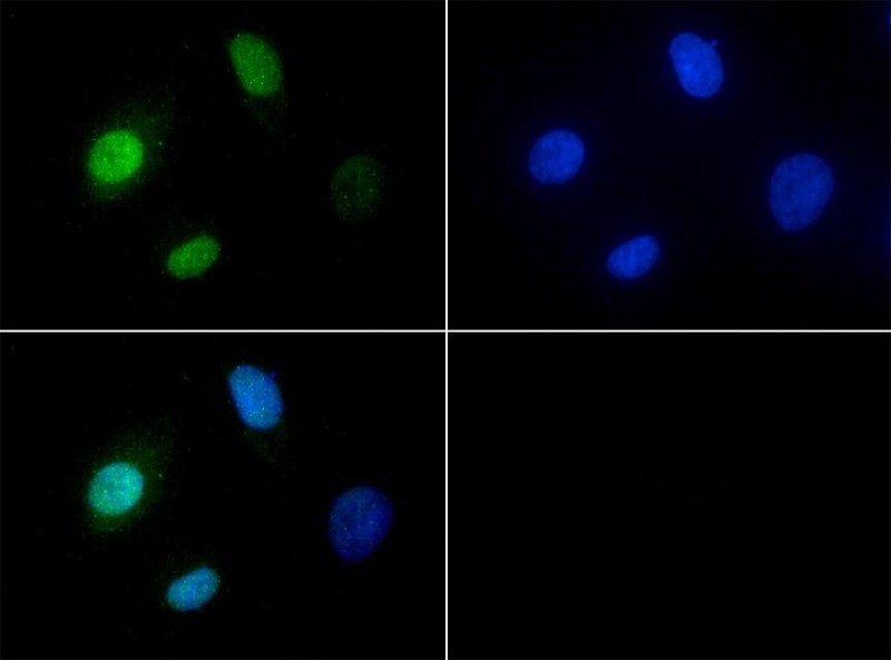 Immunocytochemistry/Immunofluorescence: KDM2A/FBXL11 Antibody - Antibody was tested in HeLa cells with FITC (green). Nuclei were counterstained with DAPI (blue).