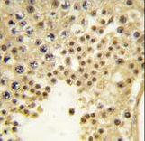 Formalin-fixed and paraffin-embedded human testis tissue reacted with JHDM1a/FBXL11 antibody , which was peroxidase-conjugated to the secondary antibody, followed by DAB staining. This data demonstrates the use of this antibody for immunohistochemistry; clinical relevance has not been evaluated.