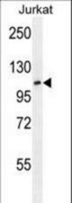 JHDM1a/FBXL11 Antibody western blot of Jurkat cell line lysates (35 ug/lane). The JHDM1a/FBXL11 antibody detected the JHDM1a/FBXL11 protein (arrow).