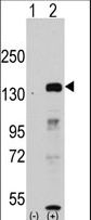 Western blot of JHDM1a/FBXL11 (arrow) using rabbit polyclonal JHDM1a/FBXL11 Antibody. 293 cell lysates (2 ug/lane) either nontransfected (Lane 1) or transiently transfected with the JHDM1a/FBXL11 gene (Lane 2) (Origene Technologies).