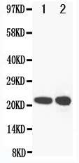 WB of GPX2 antibody. All lanes: Anti-GPX2 at 0.5ug/ml. Lane 1: Rat liver Tissue Lysate at 40ug. Lane 2: SW620 Whole Cell Lysate at 40ug. Predicted bind size: 22KD. Observed bind size: 22KD.