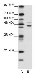 A: Marker, B: Jurkat Cell Lysate