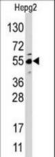 Western blot of anti-JMJD4 antibody in HepG2 cell line lysate. JMJD4 (arrow) was detected using the purified antibody.