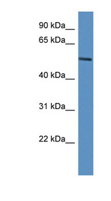 JMJD4 antibody LS-C134956 Western blot of ACHN lysate.