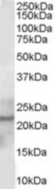 Antibody staining (1 ug/ml) of Human Prostate lysate (RIPA buffer, 30 ug total protein per lane). Primary incubated for 1 hour. Detected by Western blot of chemiluminescence.