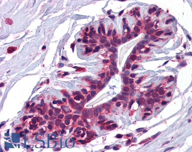 Anti-JMJD4 antibody IHC of human breast. Immunohistochemistry of formalin-fixed, paraffin-embedded tissue after heat-induced antigen retrieval. Antibody LS-B5035 concentration 5 ug/ml.