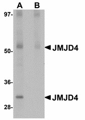 Western blot of JMJD4 in human spleen tissue lysate with JMJD4 antibody at 1 ug/ml in (A) the absence and (B) the presence of blocking peptide.