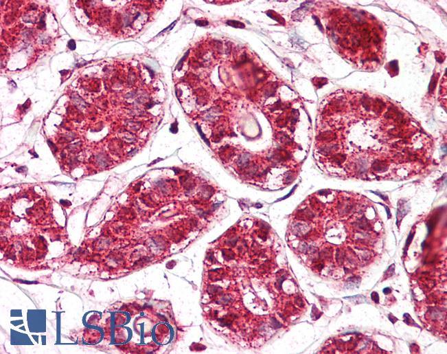 Anti-JMJD6 / PSR antibody IHC of human breast. Immunohistochemistry of formalin-fixed, paraffin-embedded tissue after heat-induced antigen retrieval. Antibody LS-B8042 dilution 5-7.5 ug/ml.