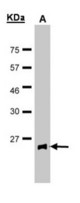 Sample(30 g of whole cell lysate). A: MOLT4. 15% SDS PAGE. GPX2 antibody diluted at 1:100.