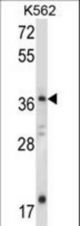 JMJD6 Antibody western blot of K562 cell line lysates (35 ug/lane). The JMJD6 antibody detected the JMJD6 protein (arrow).