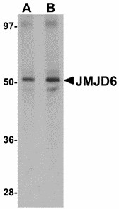 Western blot of JMJD6 in human brain tissue lysate with JMJD6 antibody at (A) 1 and (B) 2 ug/ml. Below: Immunohistochemistry of JMJD6 in rat brain tissue with JMJD6 antibody at 2.5 ug/ml.