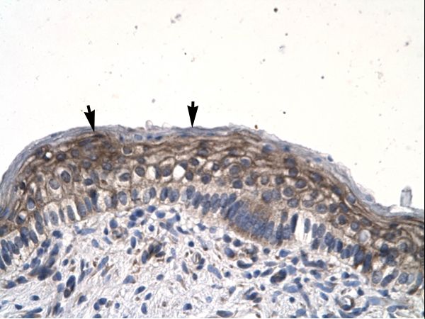 JMJD8 antibody LS-C29699 was used in IHC to stain formalin-fixed, paraffin-embedded human spermatophore.