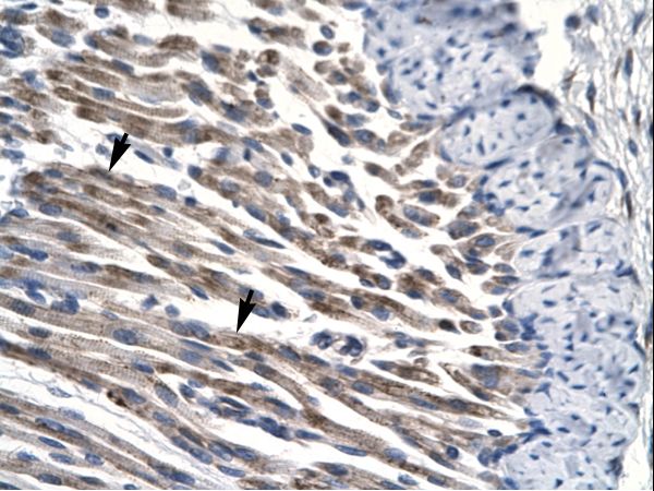 JMJD8 antibody LS-C29699 was used in IHC to stain formalin-fixed, paraffin-embedded human muscle.