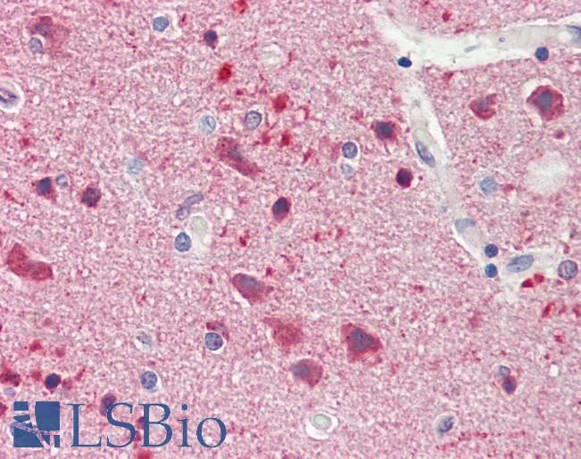 Anti-JMY antibody IHC staining of human brain, cortex. Immunohistochemistry of formalin-fixed, paraffin-embedded tissue after heat-induced antigen retrieval. Antibody LS-B9885 concentration 10 ug/ml.
