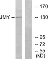 Western blot of extracts from COLO cells, using JMY Antibody. The lane on the right is treated with the synthesized peptide.